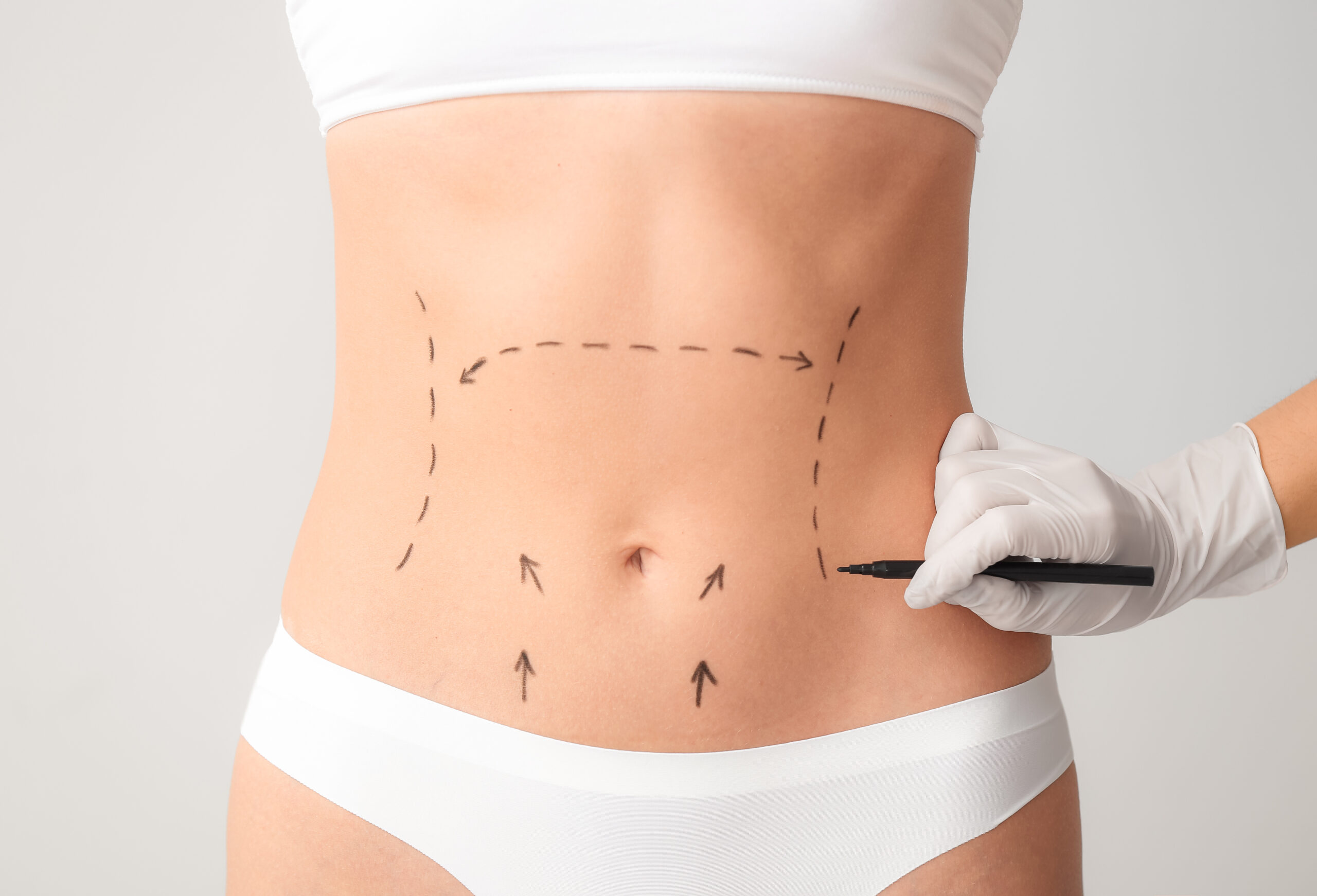 Plastic surgeon applying marks on female body against light back