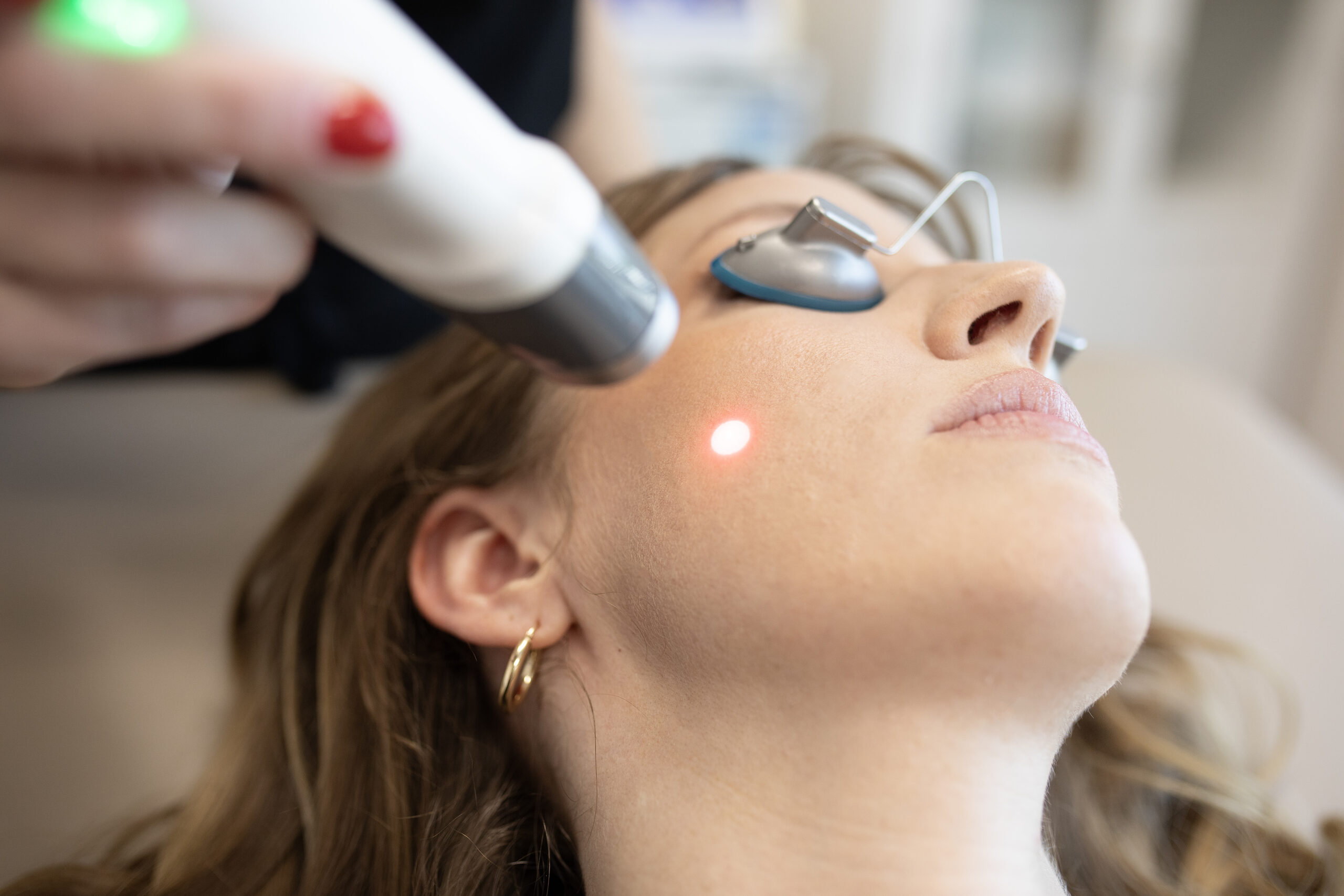 DCCC laser on face